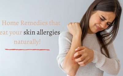 10 Home Remedies that treat your skin allergies naturally!